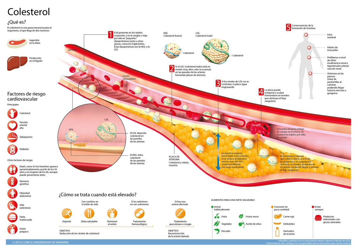 Colesterol y menopausia